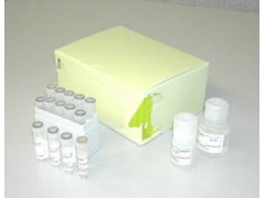 病毒核酸提取试剂盒-磁珠法图1