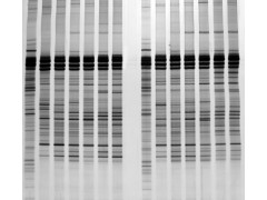微生物多样性分析（DGGE技术）图1