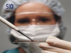 基因芯片 Slide AL 用于探针类型人工染色体(BAC)图3