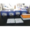 人血管抑素/血管稳定蛋白(ANG) ELISA试剂盒 ANG ELISA 试剂盒