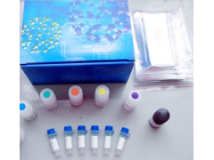 小鼠抗甲状腺过氧化物酶抗体(TPO-Ab)ELISA试剂盒