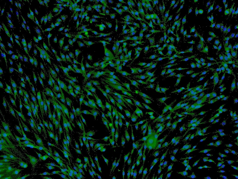 间充质干细胞培养基 MSCM