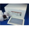 人S-100β蛋白ELISA试剂盒(S-100β ELISA Kit)