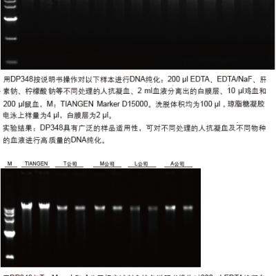 血液基因组DNA提取试剂盒（0.1-1ml）（DP348）