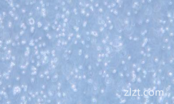 小鼠肾小球系膜细胞永生化