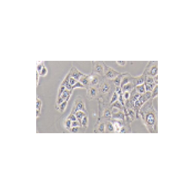 SJCRH30人骨髓横纹肌肉瘤细胞zl-056085