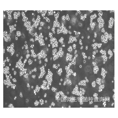 FHC人正常结肠上皮细胞（STR鉴定正确）