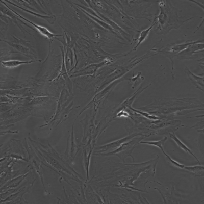 zlzt生物人视网膜母细胞瘤细胞Y79