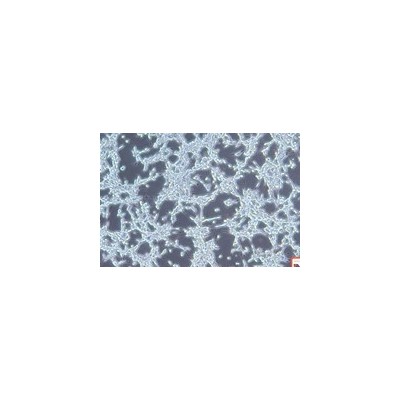 人卵巢上皮细胞癌细胞OV-1063