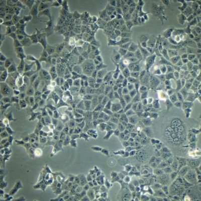 HSF细胞人皮肤成纤维细胞zl-057188