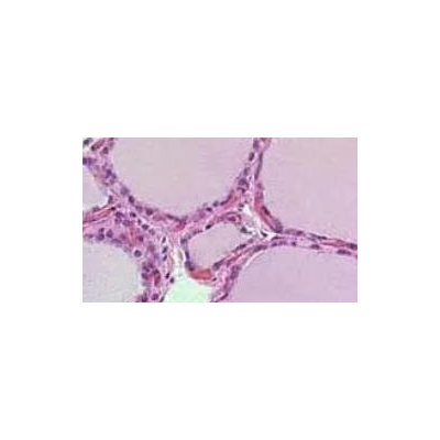 SW948(人结肠腺癌细胞)(L15)(STR鉴定正确)