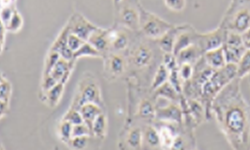 MKN-1人胃癌细胞智立中特细胞系